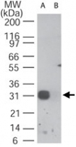 PAB0223 - RAD17