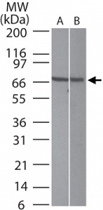 PAB0224 - Interleukin-23 receptor / IL23R