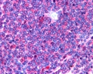 PAB0224 - Interleukin-23 receptor / IL23R