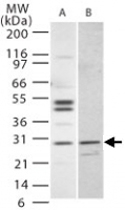 PAB0225 - Interleukin-27 / IL27A