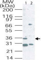 PAB0227 - CD207 / Langerin