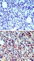 PAB0227 - CD207 / Langerin