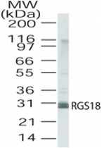 PAB0228 - RGS18