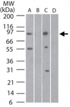 PAB0229 - TLR11