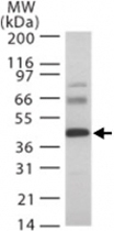 PAB0230 - HTRA3