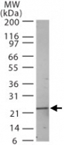 PAB0231 - RGS2