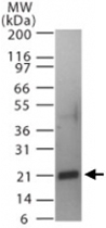 PAB0232 - CD254 / RANKL
