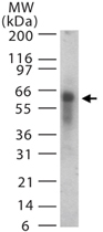 PAB0234 - ASB3