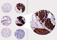 PAB0236 - Bcl-2