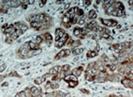 PAB0237 - Bcl-2-like 1