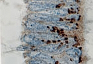 PAB0237 - Bcl-2-like 1