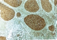 PAB0242 - Caspase-3
