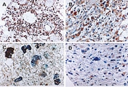 PAB0244 - Caspase-6