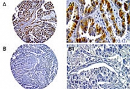 PAB0250 - Caspase-14