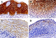 PAB0250 - Caspase-14