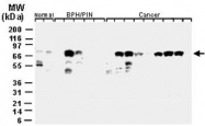 PAB0252 - IAP2 / BIRC2