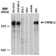 PAB0256 - PTPN13