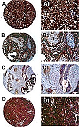PAB0256 - PTPN13