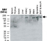 PAB0262 - CARD7 / NLRP1