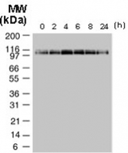 PAB0267 - NALP2