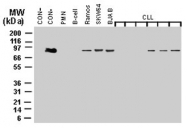 PAB0270 - MALT1