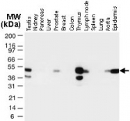 PAB0274 - TRAF1 / EBI6