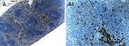 PAB0278 - TRAF5 / RNF84