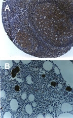 PAB0279 - TRAF6 / RNF85