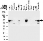 PAB0279 - TRAF6 / RNF85