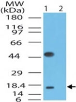 PAB0285 - ACP1 / LMW-PTPase