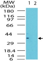 PAB0286 - LST8 / GBL
