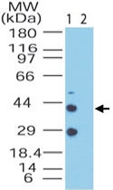 PAB0289 - NPY receptor 2 / NPY2R