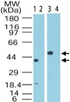 PAB0290 - MIP1