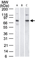 PAB0292 - BRD4