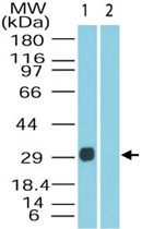 PAB0295 - DUSP13