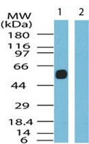PAB0299 - SSTR5