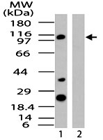 PAB0302 - RanBP8 / Importin-8