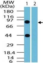 PAB0303 - BCLAF1 / BTF