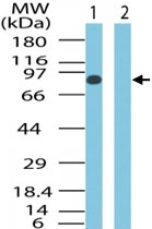 PAB0305 - SMO