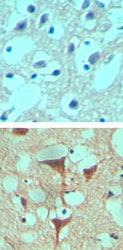 PAB0305 - SMO
