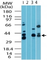 PAB0307 - MIP1