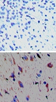 PAB0313 - TAAR1