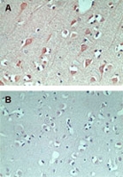 PAB0316 - FAM3C