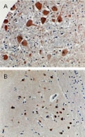 PAB0325 - APAF1