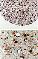 PAB0325 - APAF1