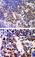 PAB0326 - PYDC1