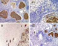 PAB0326 - PYDC1