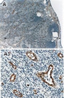 PAB0327 - MEKK5 / ASK1