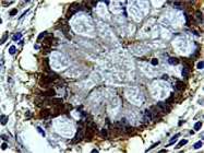 PAB0328 - BAG1
