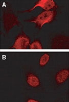 PAB0329 - BAG2